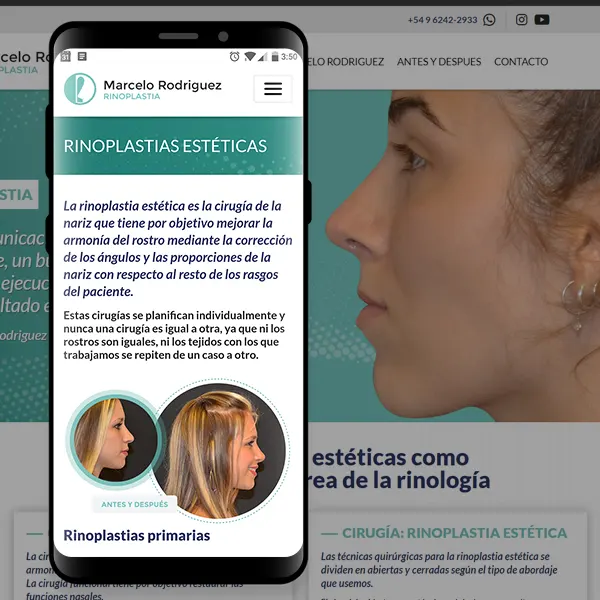 miniatura del cliente: drrodriguezrinoplastia.com.ar