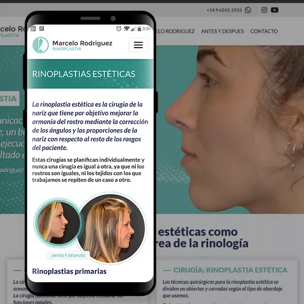 miniatura del cliente: drrodriguezrinoplastia.com.ar
