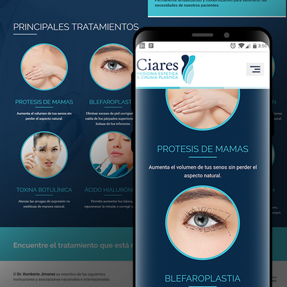 Ciares